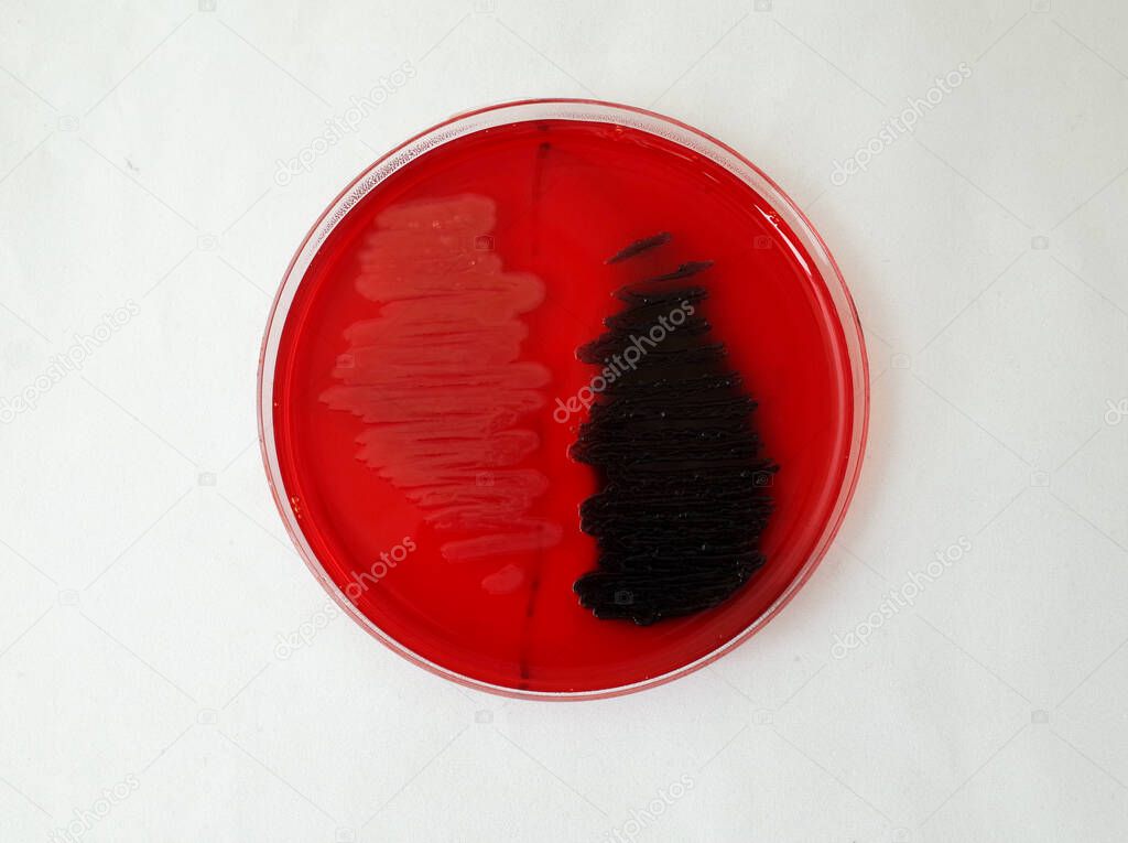 bacterial gowth on Congo red agar plate to test the ability of bacteria to broduce biofilm