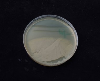 Bakteri kolonilerinin antibiyotik gradyan agar üzerindeki büyümesi bakterilerin spontane mutasyon kazanma yeteneğini test etmek için