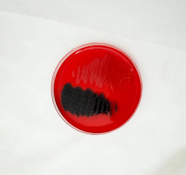 Bacterial Gowth Congo Red Agar Plate Test Ability Bacteria Broduce — Stock Photo, Image