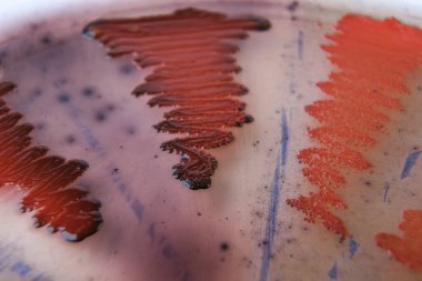 Agar medyada büyüyen bakteri kolonilerinin yakın plan fotoğrafı