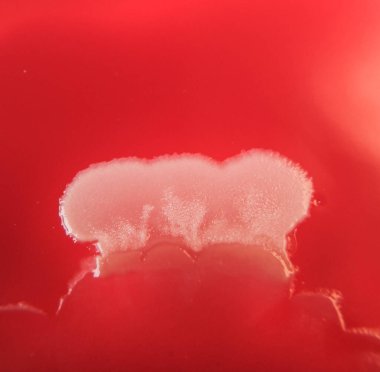 Agar medyada büyüyen bakteri kolonilerinin yakın plan fotoğrafı