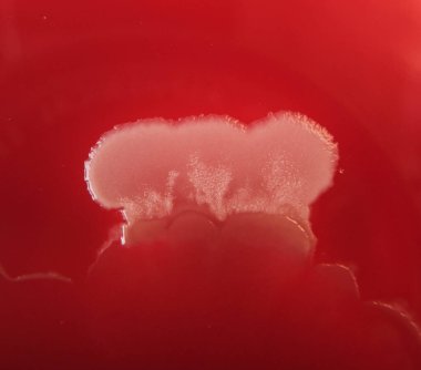 Agar medyada büyüyen bakteri kolonilerinin yakın plan fotoğrafı