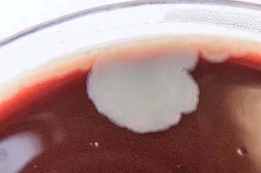 Agar medyada büyüyen bakteri kolonilerinin yakın plan fotoğrafı