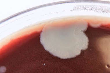 Agar medyada büyüyen bakteri kolonilerinin yakın plan fotoğrafı