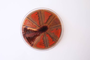 Agar medyada büyüyen bakteri kolonilerinin yakın plan fotoğrafı