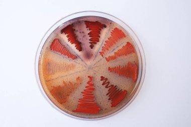 Agar medyada büyüyen bakteri kolonilerinin yakın plan fotoğrafı