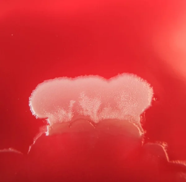 Foto Close Colônias Bacterianas Cultivadas Meios Ágar — Fotografia de Stock