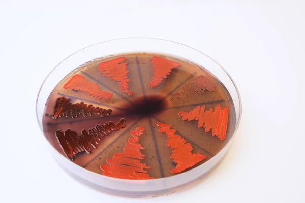 Foto Primer Plano Colonias Bacterilales Cultivadas Medios Agar — Foto de Stock