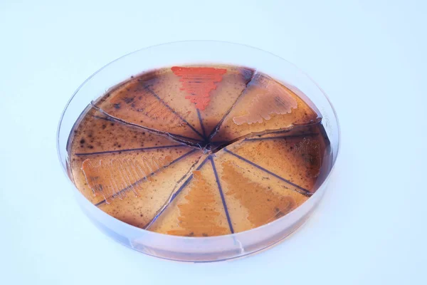 Foto Primer Plano Colonias Bacterilales Cultivadas Medios Agar —  Fotos de Stock
