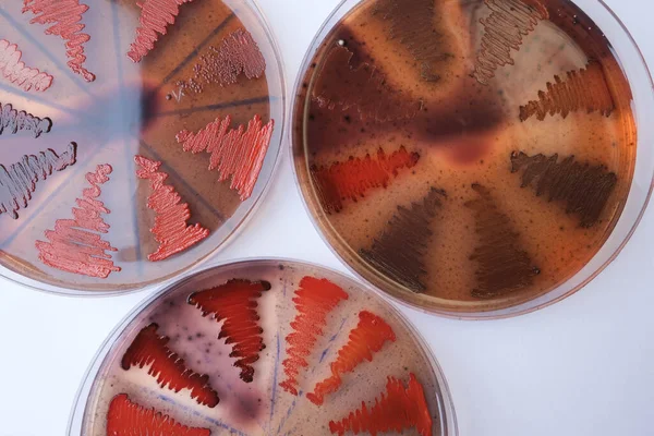 Agar Medyada Büyüyen Bakteri Kolonilerinin Yakın Plan Fotoğrafı — Stok fotoğraf