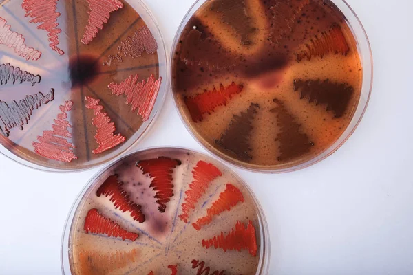 Agar Medyada Büyüyen Bakteri Kolonilerinin Yakın Plan Fotoğrafı — Stok fotoğraf