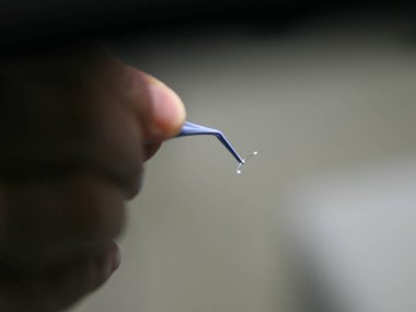 Basra, Irak - 12 Ağustos 2010: Keratoconus tedavisi için intacs halkalarının fotoğrafı