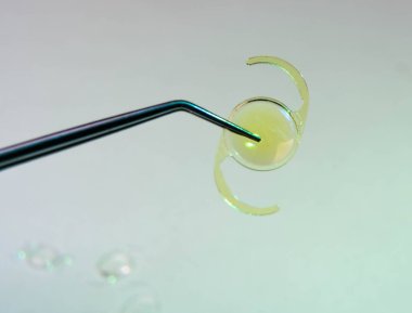 Katarakt ameliyatı için katlanabilir itraoküler merceğin yakın plan fotoğrafı