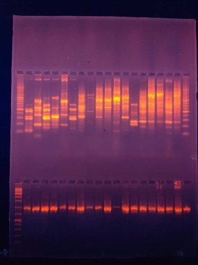 GEL 'e karşı DNA bantları