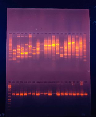 GEL 'e karşı DNA bantları