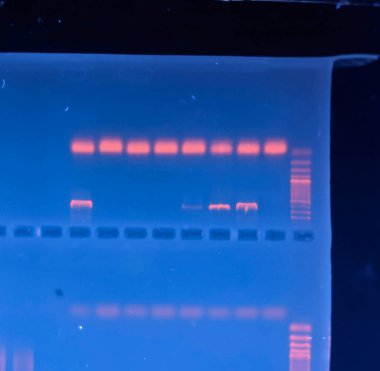 GEL 'e karşı DNA bantları