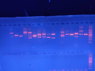GEL 'e karşı DNA bantları