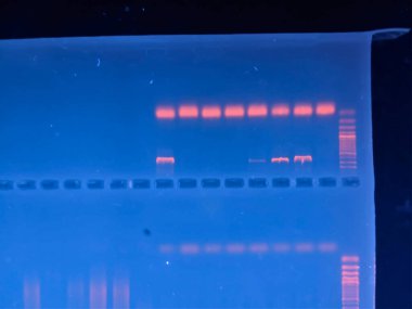 GEL 'e karşı DNA bantları