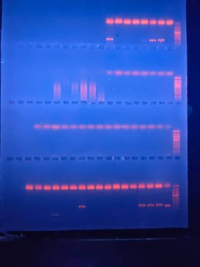 GEL 'e karşı DNA bantları