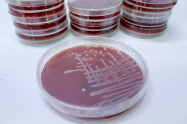 Agar Ortamı Bakteri Kültürü