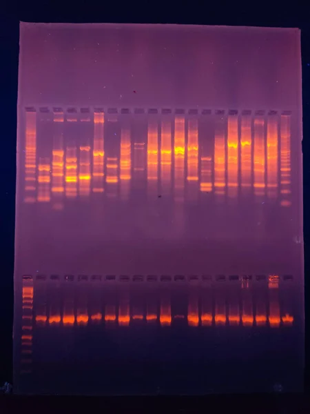 Bandas Dna Gel Agarose — Fotografia de Stock