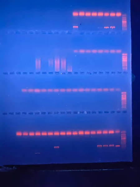 Группы Днк Agarose Gel — стоковое фото