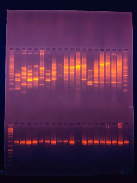 Bands of DNA ON AGAROSE GEL