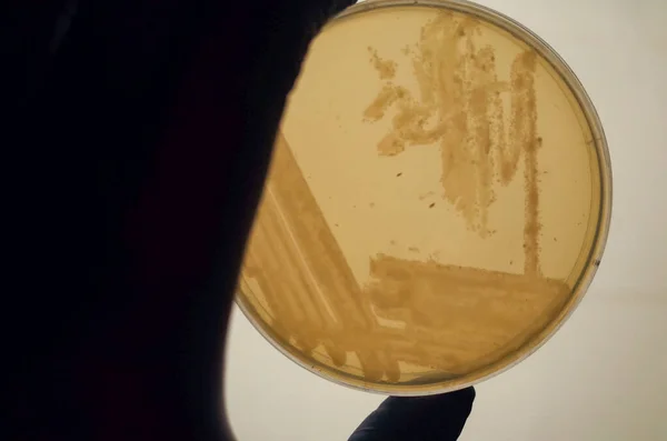 Agar Ortamı Bakteri Kültürü — Stok fotoğraf