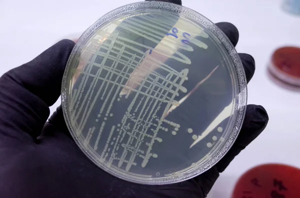 Bacteria Culture on agar media