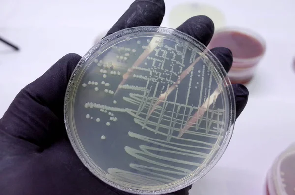 Bacteria Culture on agar media