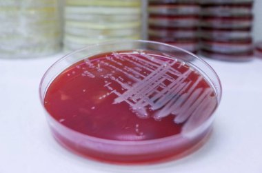 Agar Ortamı Bakteri Kültürü