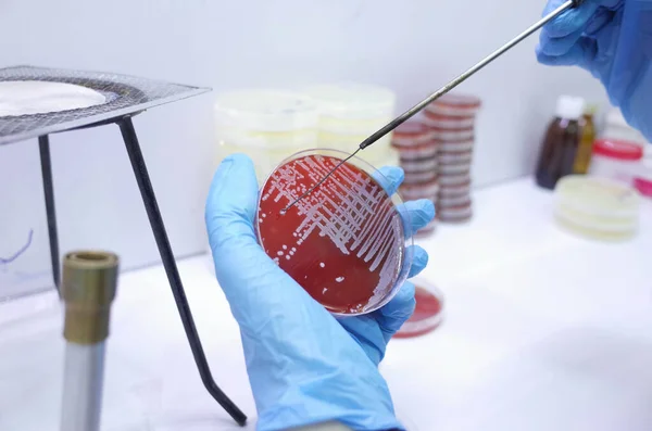 Bacteria Culture on agar media