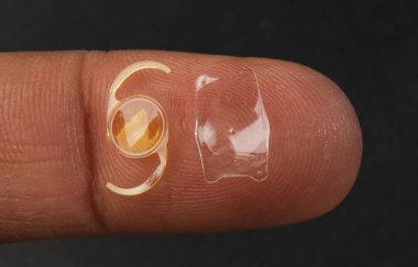 İmplante edilebilir kolamer lensin yakın plan fotoğrafı ICL ve intra ocu