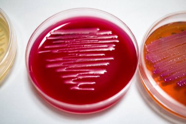Bakteri kültürü olan üç petri kabı, birinde parlak pembe bir ortam, diğerinde sarı bir ortam, ve sonuncusunda turuncu bir ortam, farklı büyüme şekilleri sergiliyor.