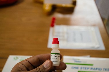 Tahta bir masada kırmızı şapkalı, hızlı bir test için örnek olarak etiketlenmiş küçük bir şişeyi tutan bir el.