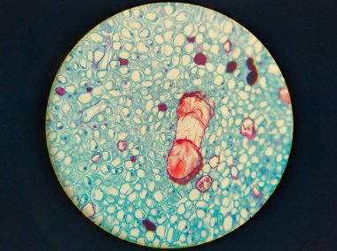 Biyolojik bir örneğin mikroskobik görüntüsü hücreleri ve yapıları gösterir, açık mavi ve beyaz hücrelerle çevrili belirgin kırmızı uzatılmış bir yapısı vardır.