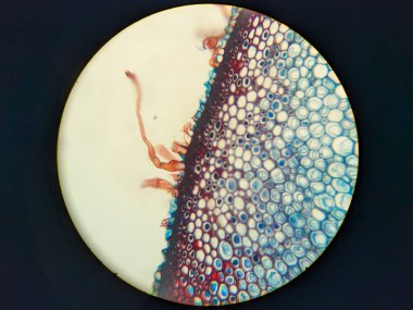 Mikroskop altında bitki dokusunun yakın plan görüntüsü, farklı hücre tipleri arasında belirgin bir sınır bulunan renkli hücreleri ve yapıları gösteriyor.