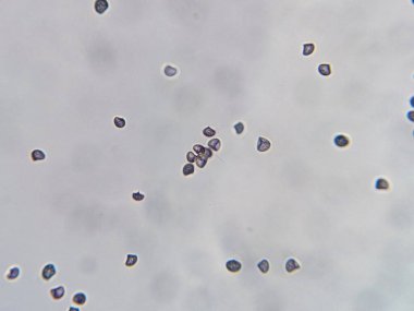 Küçük yuvarlak hücrelerin şeffaf arkaplan ile mikroskobik görünümü