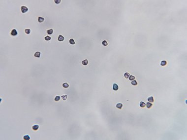 Küçük, yuvarlak parçacıkların mikroskobik görünümü açık bir arkaplanda değişik mavi ve mor tonlara sahip