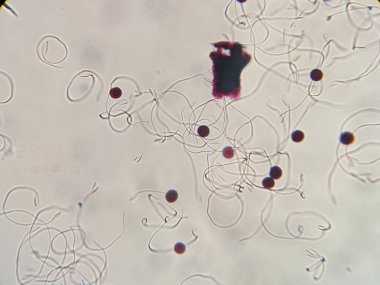 Çeşitli şekil ve hareketleri gösteren sperm hücreleri ve kırmızı kan hücrelerinin mikroskobik görüntüsü