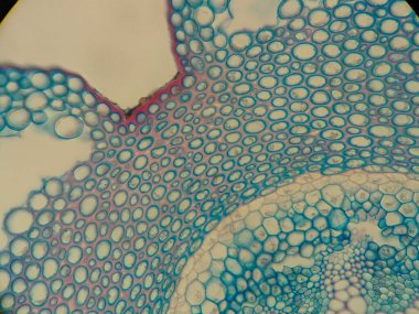 Bitki hücrelerinin mikroskobik görüntüsü mavi ve pembe lekeli dairesel şekiller gösteriyor