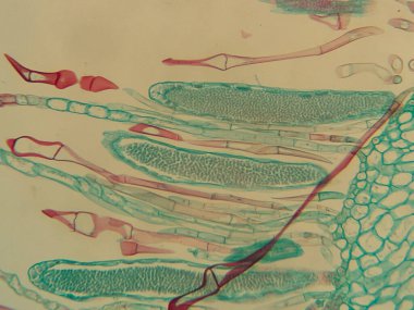 Genişlemiş hücreleri ve vasküler yapıları gösteren mikroskobik bitki dokusu görüntüsü berraklık için boyanmış.