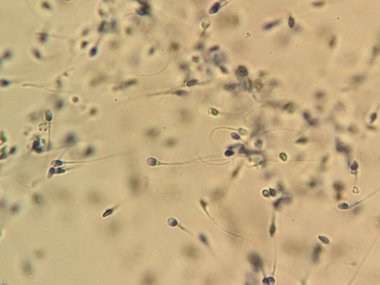 Sıvı bir ortamda sperm hücrelerinin mikroskobik görüntüsü, hareketliliklerini ve yapılarını gösteriyor