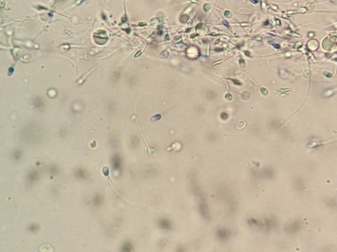 Sperm hücreleri ve diğer hücresel yapılar da dahil olmak üzere çeşitli mikroorganizmaların mikroskobik görüntüsü aktif hücrelere odaklanarak bulanık bir arka plan sergiliyor.