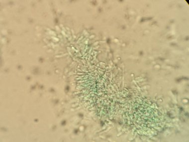 Mikroskobik bir hücre kümesi ya da mikroorganizma görüntüsü, karmaşık detaylar ve dokular sergiliyor