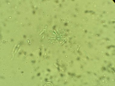 Yeşilimsi arkaplandaki çeşitli hücresel yapıların mikroskobik görünümü