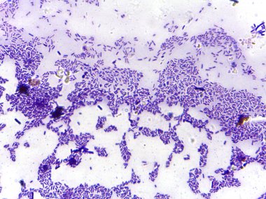 Bir örnekte mikroskobik bakteri görüntüsü, görünürlük için lekelenmiş kümeler ve bireysel hücreleri gösteriyor
