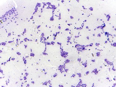 Bir örnekte mikroskobik bakteri görüntüsü, çeşitli şekilleri ve boyutları gösterir, ağırlıklı olarak açık arkaplan karşısında mor renkler