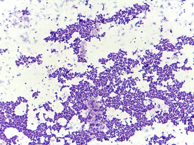 Beyaz zemin üzerinde mor lekeli hücrelerin mikroskobik görüntüsü kümeleri ve dağınık hücreleri gösteriyor, muhtemelen biyolojik bir örnek ya da doku bölümünü gösteriyor.