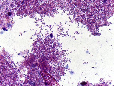 Bir slayttaki mikroskobik bakteri kolonileri görüntüsü, açık bir arkaplanda küçük, mor lekeli mikroorganizmalar kümelerini gösteriyor
